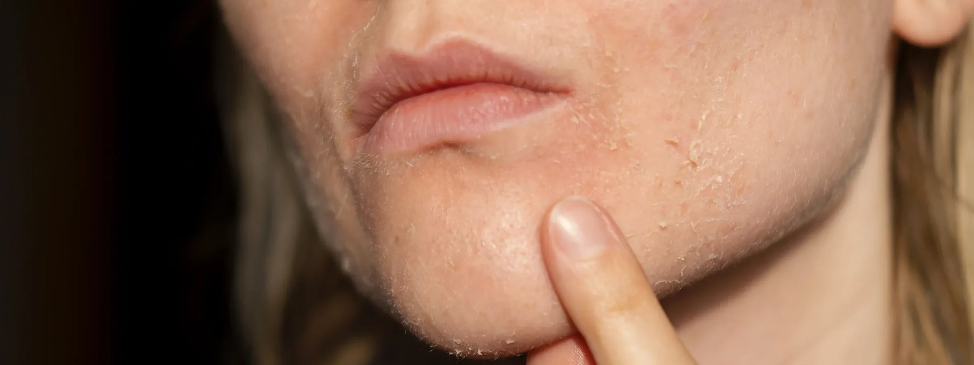 7 Moisturizing Products for Your Dry Skin 