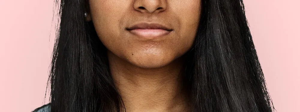 What Causes Hyperpigmentation: Expert Insights 