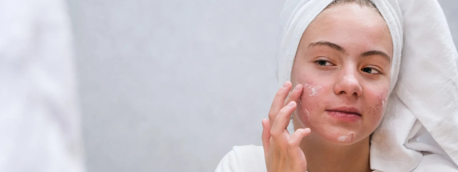 Why Scrubbing Acne-Prone Skin Spreads Breakouts: FAQ 