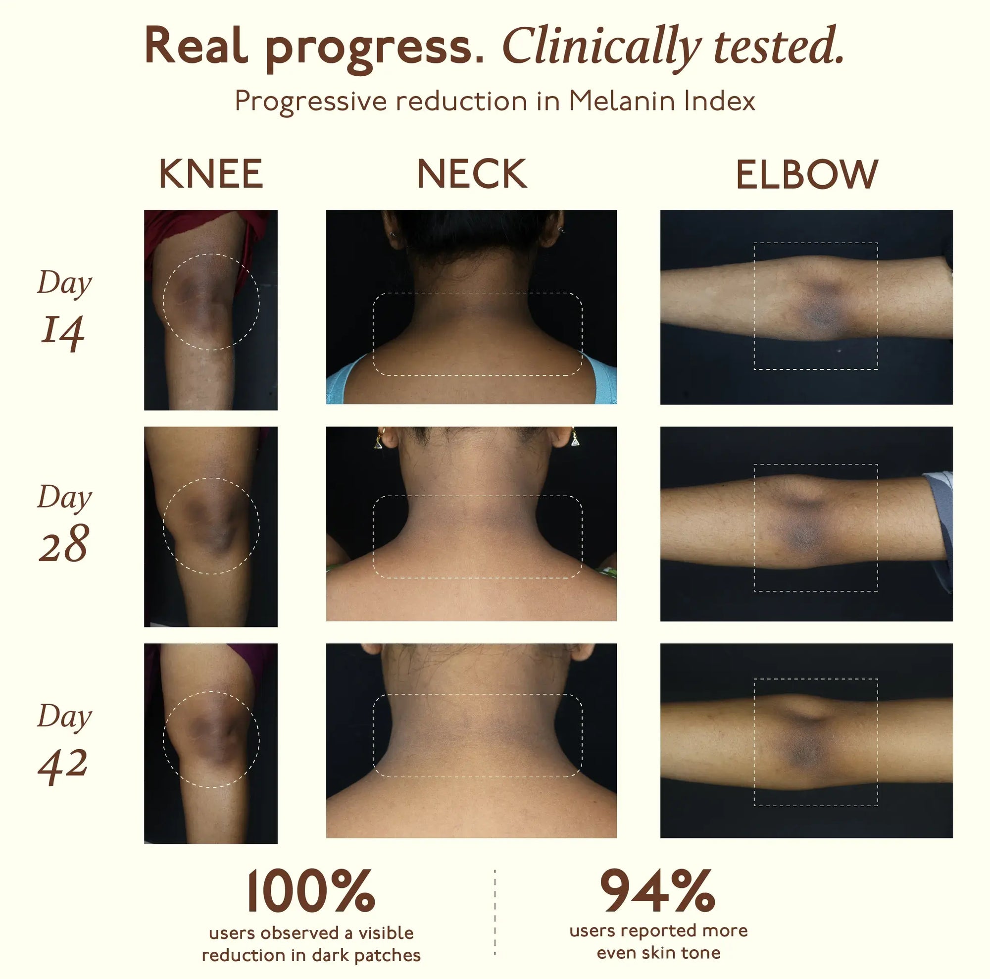 Tone Restore Knee-Neck-Elbow Cream