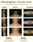 Tone Restore Knee-Neck-Elbow Cream