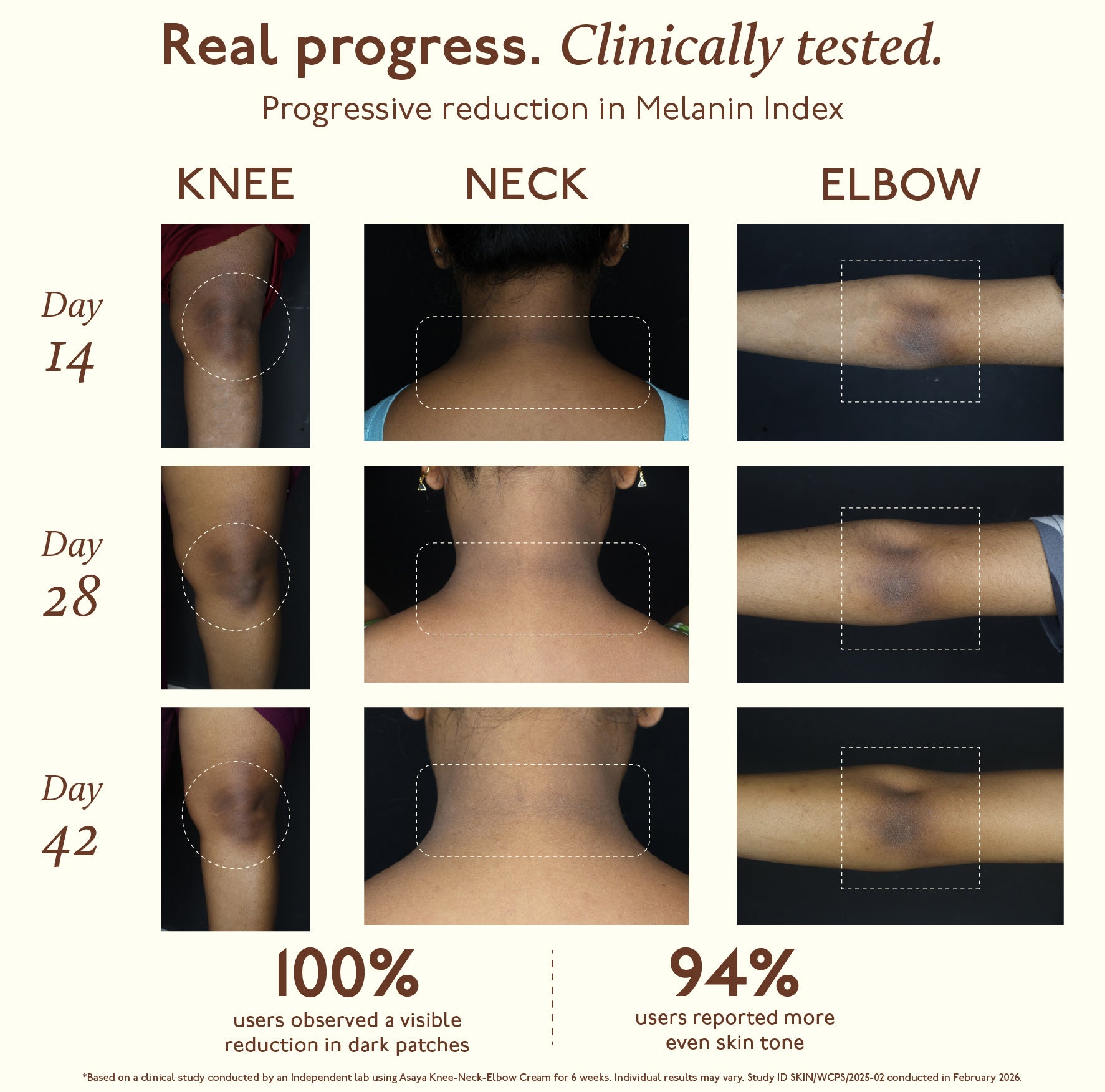 Tone Restore Knee-Neck-Elbow Cream