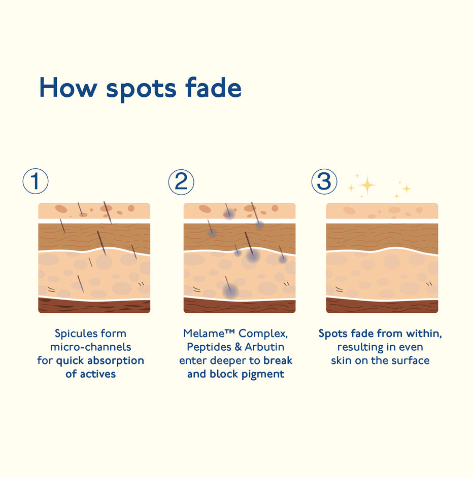 Advanced Spot Targeting Gel for Dark Spots, Acne Marks & Pigmentation ...